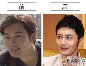 明星受伤全集图片,全集图片背后的感人故事