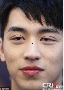 那些明星割双眼皮,揭秘割双眼皮背后的美丽秘密