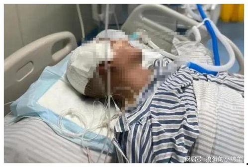 济南318吃瓜群众,吃瓜群众的围观盛宴